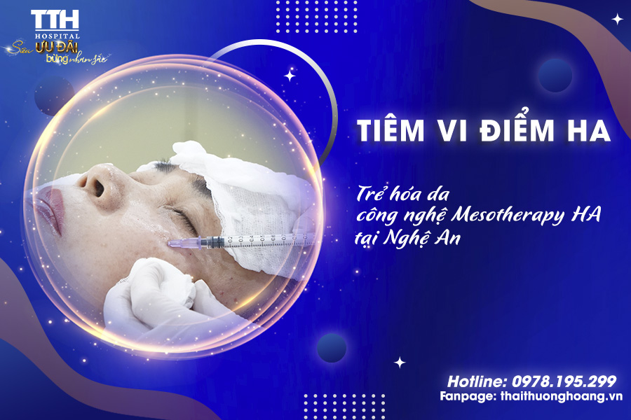 Tiêm vi điểm HA là gì? Trẻ hóa da công nghệ Mesotherapy HA tại Nghệ An